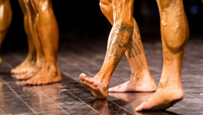 Milchsäure und Laser: Das Tattoo muss weg!