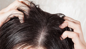 Der No-Poo-Trend: Kein Shampoo für die Haare!?