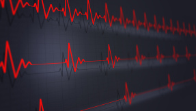 App Heartbeats erkennt unregelmäßigen Herzschlag