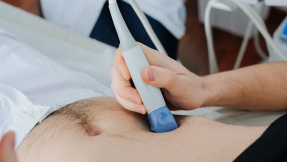 Bauchaortenaneurysma: Männer ab zum Ultraschall