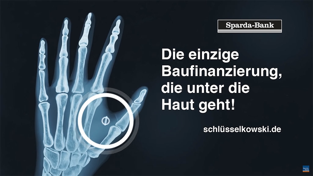 NFC-Implantat der Sparda-Bank Berlin