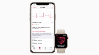 Apple Watch: EKG