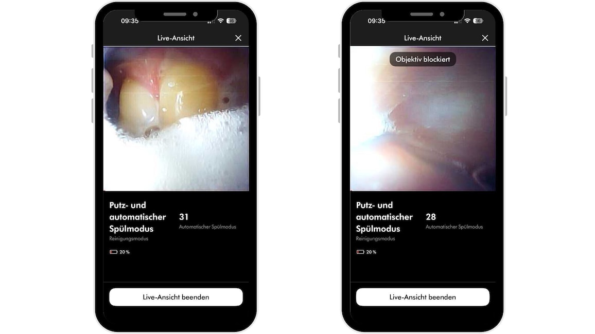 Faszinierend, aber nicht immer perfekt: Die Liveansicht der Kamera hilft bei der Kontrolle der Zahnzwischenräume, die Erkennung funktionierte im Test jedoch nicht durchgehend zuverlässig.
